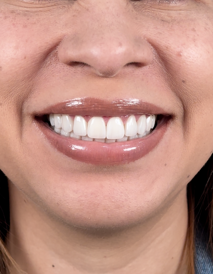 Sonrisa cuidada